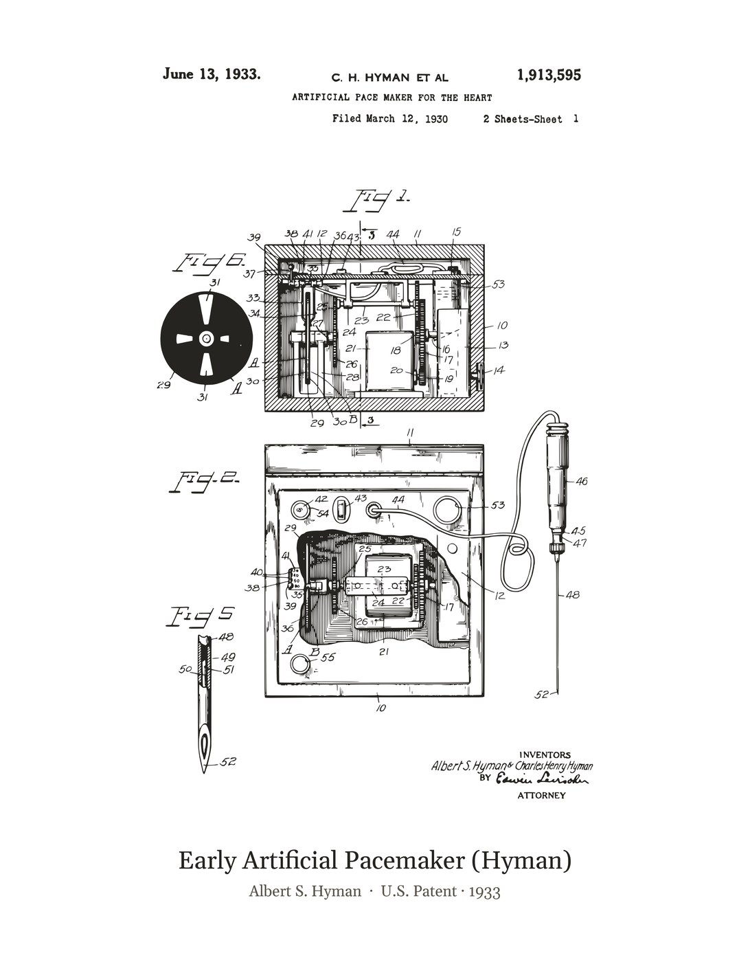 Early Artificial Pacemaker (Hyman) patent art print