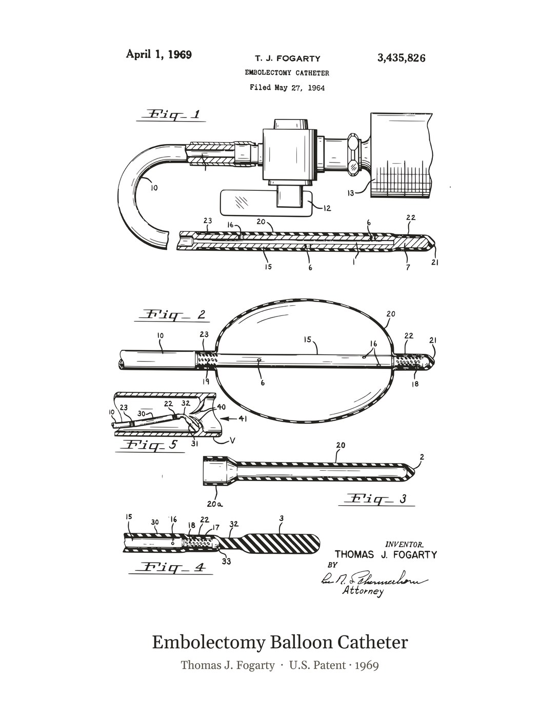 Embolectomy Balloon Catheter patent art print