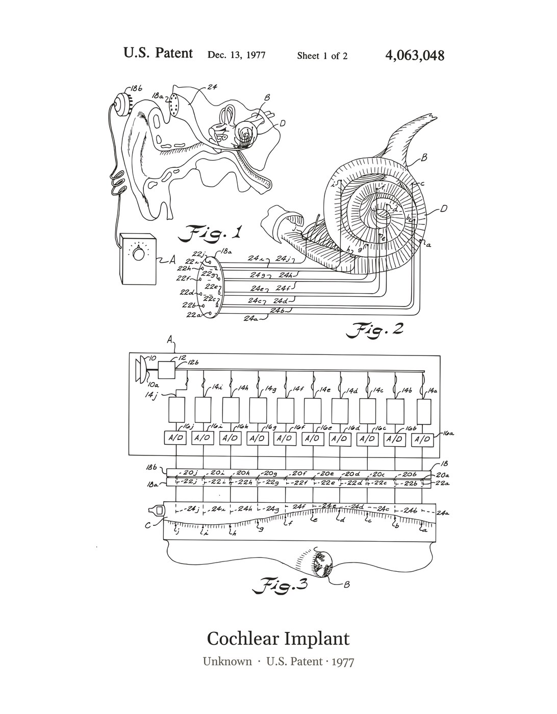 Cochlear Implant patent art print