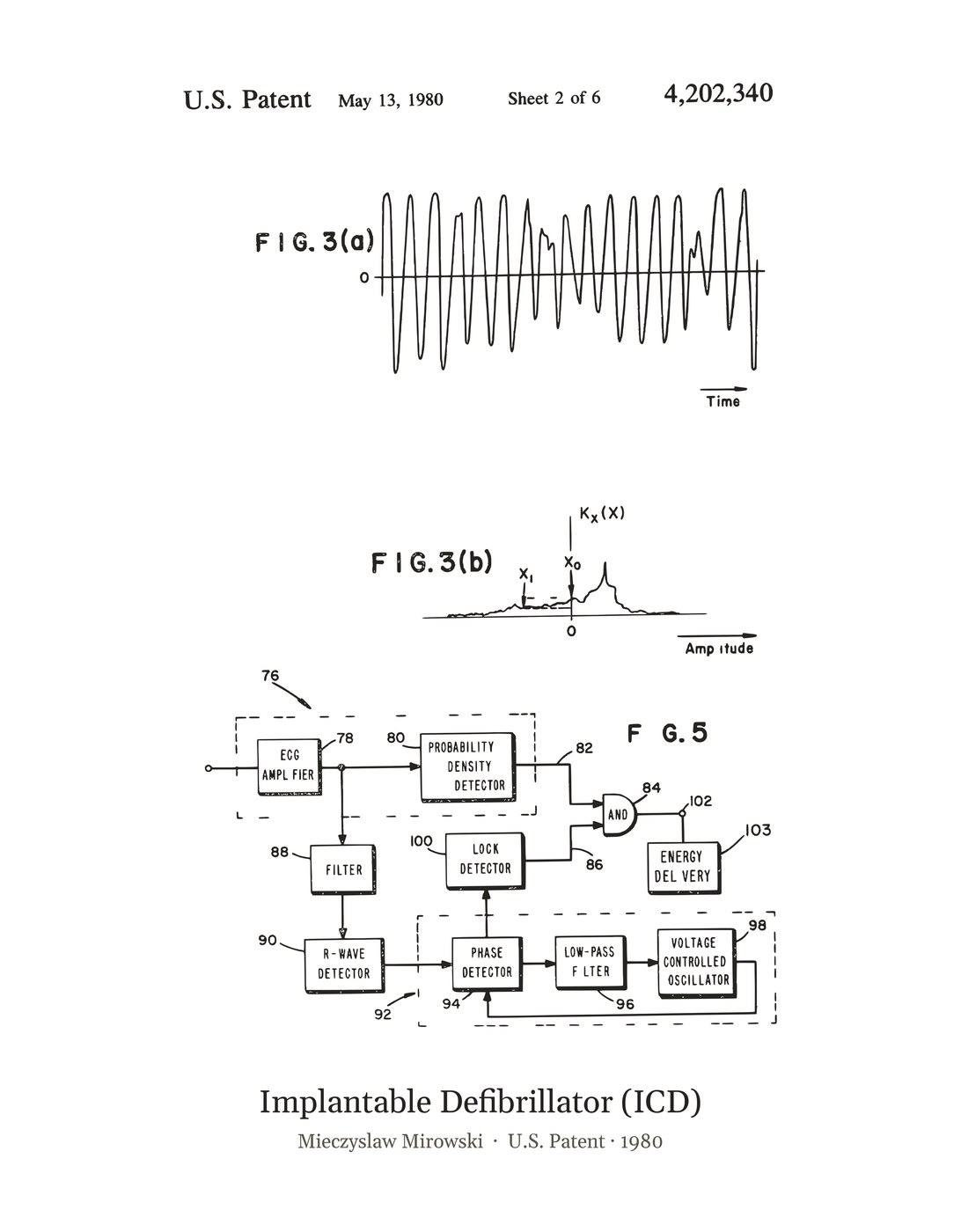 Implantable Defibrillator (ICD) patent art print