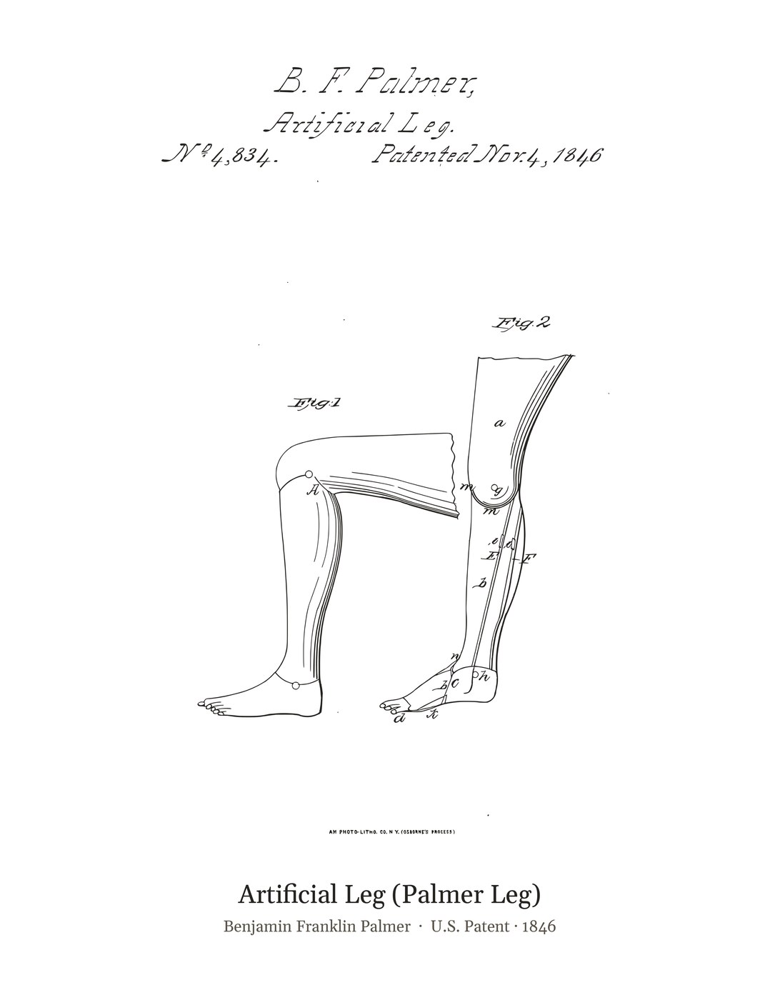 Artificial Leg (Palmer Leg) patent art print